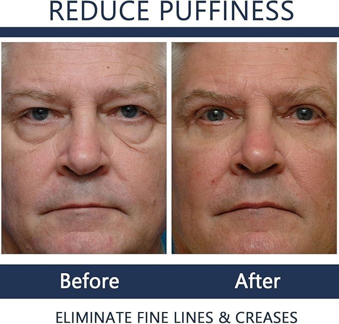 Men Eye Cream Anti Aging