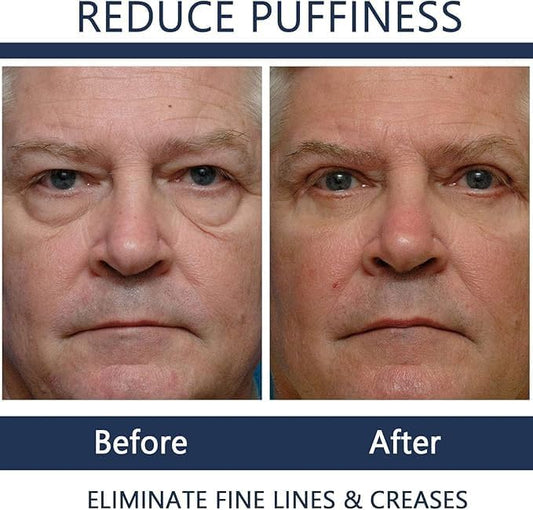 Men Eye Cream Anti Aging